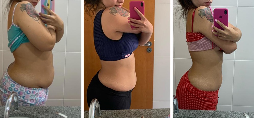 Antes e depois 3