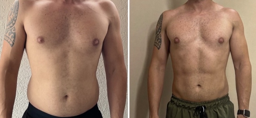 Antes e depois 7